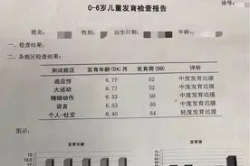 3个月小孩总是“睁不开眼”，没想到身患这种罕见疾病图片