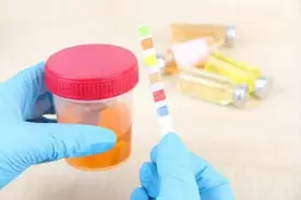世界肾脏日｜预防肾脏疾病，协和医生带您一文读懂尿常规图片