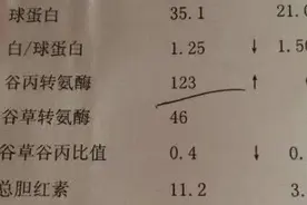 体检报告单中“转氨酶”偏高，意味着什么？看看医生怎么说图片