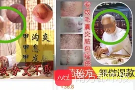 封禁！“网络神医”制造链条曝光，涉事平台称已处理相关账号图片
