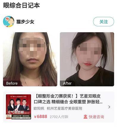 更美app签到活动遭用户集中投诉 医美案例分享者性别忽男忽女真实性存疑