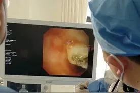 猪蹄吃太快 老太将骨头吞咽进气管图片