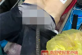 看着都疼！北海一工人被钢筋刺穿下体，钢筋长约90厘米图片
