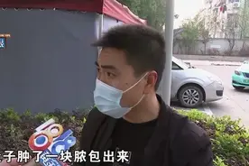 阑尾手术创口发炎，脓疱里挤出夹子？图片