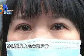 双眼皮手术以后，左眼成了“三角形”？图片