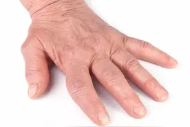 近期手脚突然莫名出现以下几个症状，当心就是癌变已经敲响了信号图片