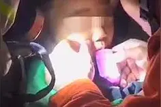万物皆可“卡”…6岁男孩嘴唇被糖果盒卡！住！了图片