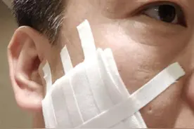 陕西一高管用烟头烫伤下属脸，当事人已被免职并通报批评图片