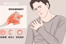 每天200个深蹲减肥，长沙18岁大学生患急性肾衰，小便呈红色……图片
