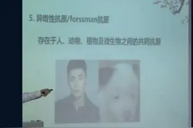 李荣浩撞脸狗狗图片被当作生物课件 本尊幽默回应图片