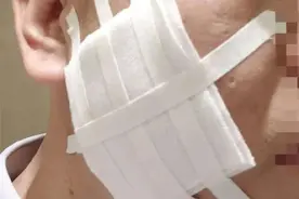 太过分！公司高管用烟头烫员工脸！面对职场霸凌该怎么做？图片