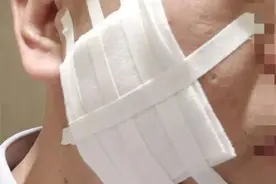 太过分！公司高管用烟头烫员工脸！面对职场霸凌该怎么做？图片