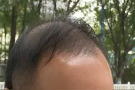 男子正理发，突然“咔嚓”一声...最担心的事发生了图片