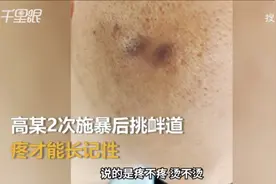 员工称被高管烟头烫脸，还被挑衅“疼才长记性”！涉事公司回应：系酒后行为图片