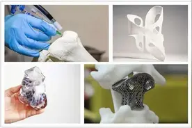肿瘤不幸长在骨骼上是绝症吗？3D打印带来福音图片