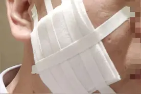 职员遭烟头烫脸，高管被刑拘图片