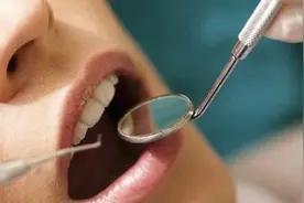 口腔溃疡不要轻视，长期反复发作真的会致癌图片