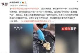 英媒：泰男子爱吃生肉长18米长绦虫图片