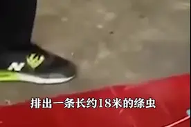 吓人！泰国一男子体内排出18米长绦虫，跟这样食物有关图片