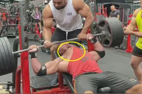 健美运动员训练时出意外 胸肌从骨头上剥离图片