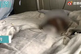河南一女子提分手遭男友泼汽油点燃，邻居：不能扶，一扶肉就掉了图片