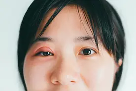 管住手！麦粒肿千万不能随便挤视频封面