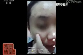 美容变毁容：荧光脸、激素脸频现……皮肤科专家：一定要远离这些“陷阱”图片