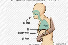 婴幼儿误吞异物，这个急救法必须学会图片