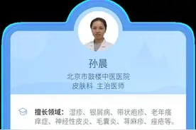 “瘊子”分公母，母的会传染？图片