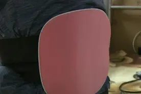 男子腰痛“针刺放血”治疗，满腿遍布针眼险瘫痪图片