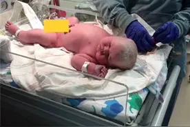 英国女子产下“巨婴”孩子出生就有13斤重图片