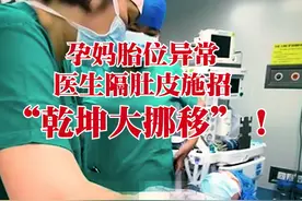 视频｜孕妈胎位异常，这位佛山医生隔肚皮施招“乾坤大挪移”图片