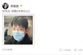 井柏然晒自拍力证没秃头 网友：然然哥才不是秃头小宝贝呢图片