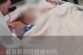 仍未苏醒！7岁男童全麻拔牙昏迷40天图片