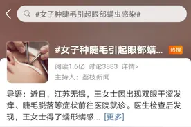 种睫毛眼部螨虫感染！专家提醒出现这些症状或已中招图片