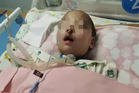 男童拔牙后昏迷40天，拔牙有风险？华西口腔医院专家：拔牙本身不会导致昏迷图片