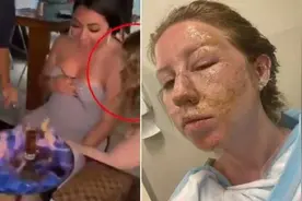 可怕瞬间！美国一女子墨西哥度假时被餐厅特效表演烧伤面部图片