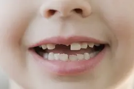 儿童乳牙脱落后，多久能长出恒牙？视频封面