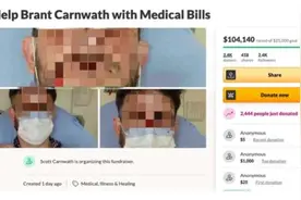 美国男子自称为救亚裔被打还发起众筹，真相没这么简单图片