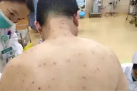 大群蜜蜂扑向老婆！男子做了这个决定图片