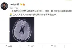 何小鹏称每个鹏友脑子里都“长”了个小鹏 引网友炮轰图片