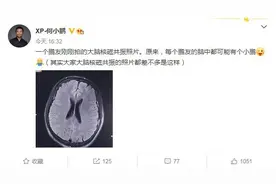 何小鹏称每个鹏友脑子里都“长”了个小鹏 引网友炮轰图片