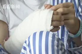 男子被小黄鱼刺扎伤 2个月后险些截肢图片