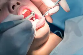 种植一口牙，县城一套房，种牙为何这么贵？图片