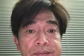 吴宗宪拔牙后脸肿大包 自嘲：史上最肿，但会很快帅回来图片