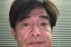 吴宗宪拔牙后脸肿大包 自嘲：史上最肿，但会很快帅回来图片