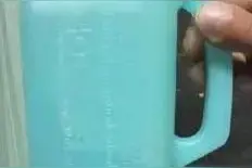 200个深蹲过后，一初中生险些血透图片