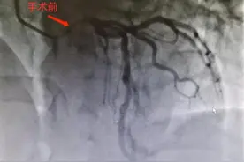 好险！浙江男子突然胸闷，检查指标都正常，结果差点没命图片