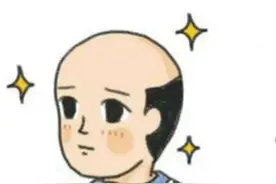 吴彦祖、梁朝伟都守不住的"发际线" 其实还有救图片