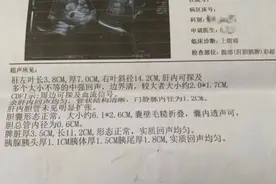 医生揭露肿瘤治疗黑幕引关注！患者家属还原治疗全过程图片